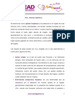 Quistes hepáticos: causas más comunes