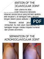 ACROMIOCLAVICULAR JOINT