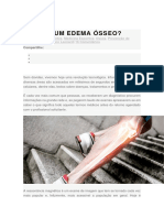 O Que É Um Edema Ósseo