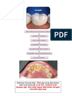 Dental Plaque