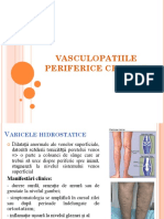 vasculopatiile periferice