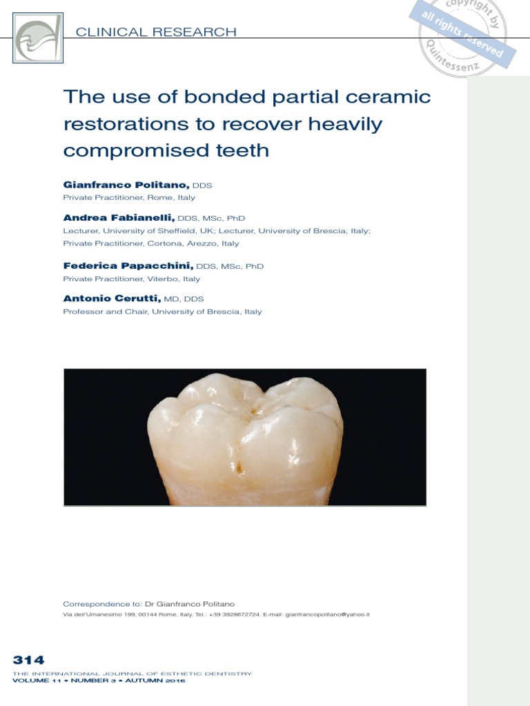 OVERLAY Dental Composite Mouth