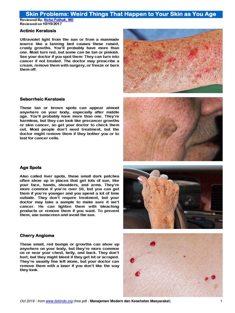 Skin Problems Weird Things That Happen To Your Skin As You Age Medicinenet Wound Dermatology