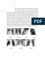 TBC Radiography