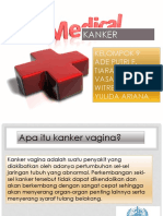 Power Point Kanker Vagina