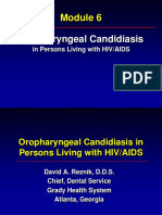Module 6 - Oropharyngeal Candidiasis in Persons Living With HIV AIDS