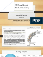 CT Scan Kepala dan Kelainannya