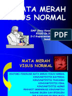 Kuliah 4 - Penyakit Mata Merah Visus Normal (Dr. Bagas)