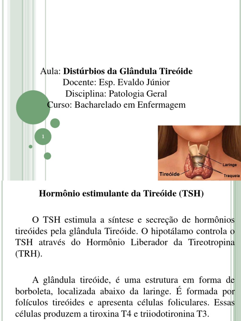 Distúrbios da Tireóide na Enfermagem | PDF | Tireoide | Hipertireoidismo, image size:768x1024