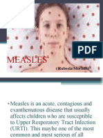 Measles Ppt