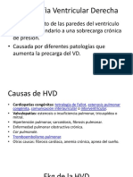 Hipertrofia Ventricular Derecha y Ekg de Pericarditis