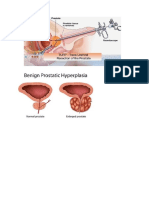 GAMBAR PROSTAT.docx