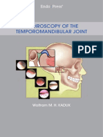 Arthroscopy of The Temporomandibular Joint