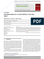 Indian Journal of Dentistry Volume 5 Issue 2014 [Doi 10.1016_j.ijd.2013.07.002] Bansal, Mohit_ Jain, Kanu_ Gupta, Shipra -- Oral Lichen Planus in a 13 Year Old Boy- A Rare Case Report_2