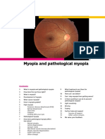 Myopia APDF PDF