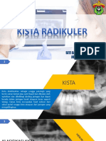 Kista Radikuler PDF
