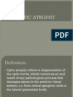 Optic Atrophy