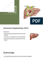 33 TUMORI HEPATICE MALIGNE.pptx