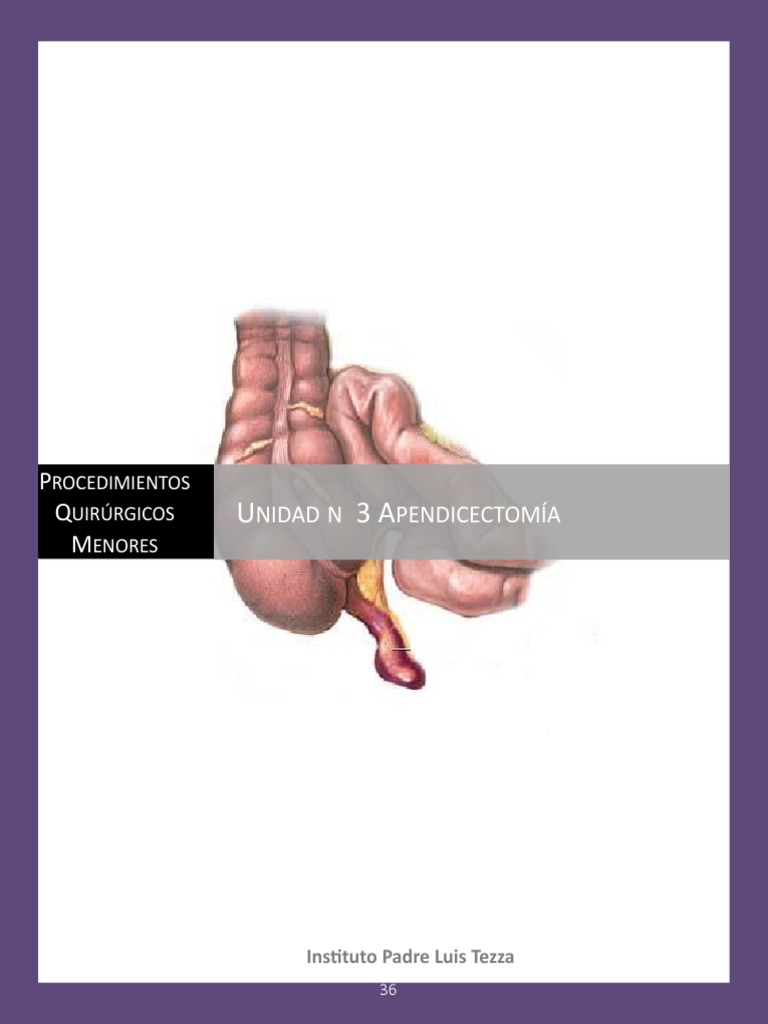 Apendicectomía: Procedimiento Quirúrgico | PDF | Gastroenterología ...