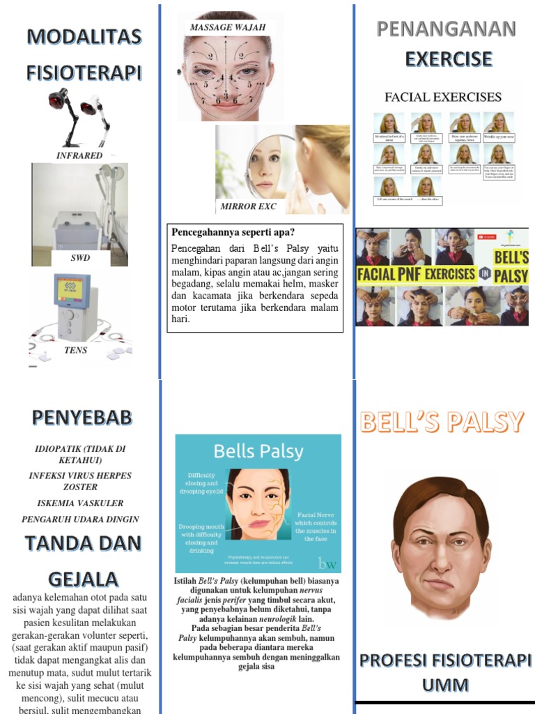 Bells Palsy Fix | PDF