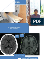 MRI BRAIN FINAL dr shamol.pdf
