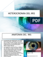 Heterocromia Del Iris