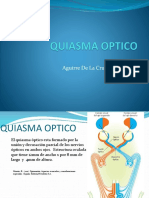 Quiasma Optico