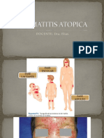 Dermatitis Atopica