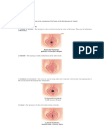 Legal Medicine Report on Hymen Classification