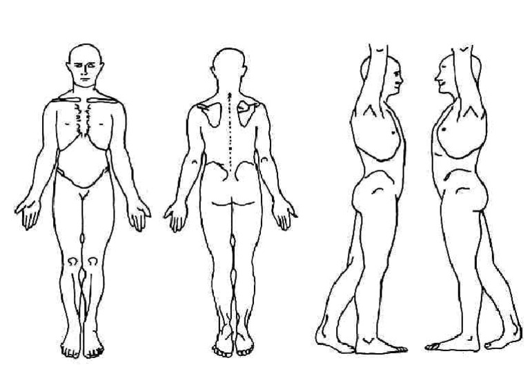 Body Chart PDF | PDF
