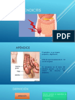 Apendicitis