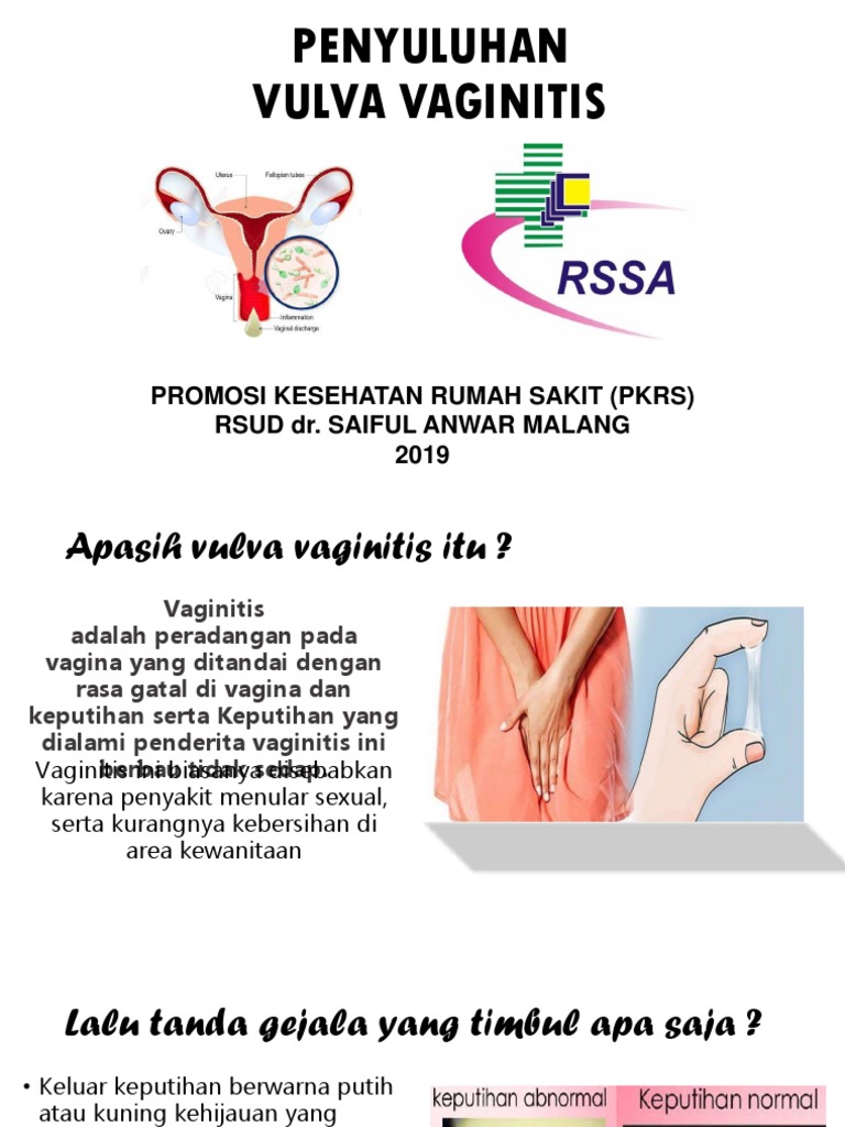 Yalangoch mashhurlar Anna Bolshova