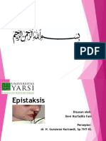 Epistaksis