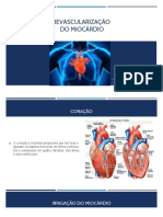 RevascMI: Revascularização do Miocárdio