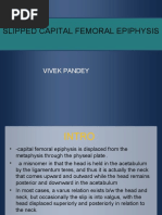 Slipped Capital Femoral Epiphysis: Vivek Pandey