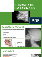 Radiografia de Cavum y Atm