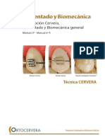 Prescripcion Cervera Cementado Biomecanica General Noviembre 2016 PDF