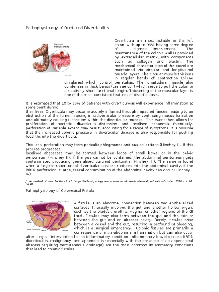 Pathophysiology of Ruptured Diverticulitis | PDF | Gastrointestinal ...