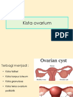 427937835-Kista-ovarium.pptx