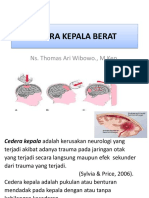 Cidera Kepala Berat