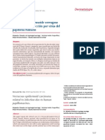 Carcinoma Epidermoide