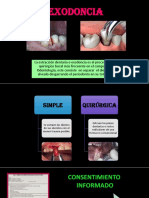 Exodoncia: extracción dental quirúrgica