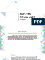 Amputasi Below Knee