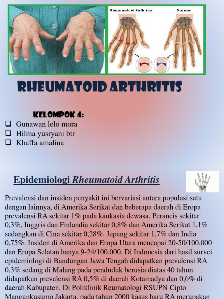 Rheumatoid Arthritis | PDF