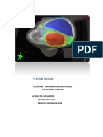 Tumores Cerebrales o de Sistema Nervioso Central SNC