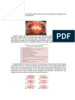 DIASTEMA