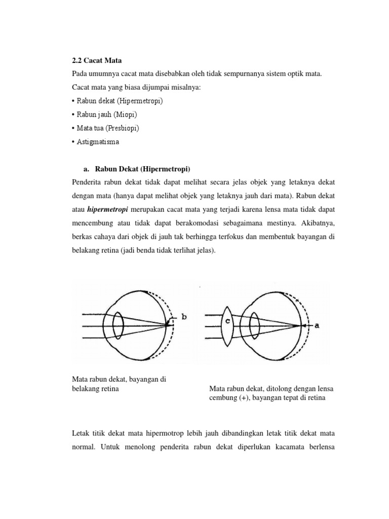Cacat Mata Lup A Rabun Dekat