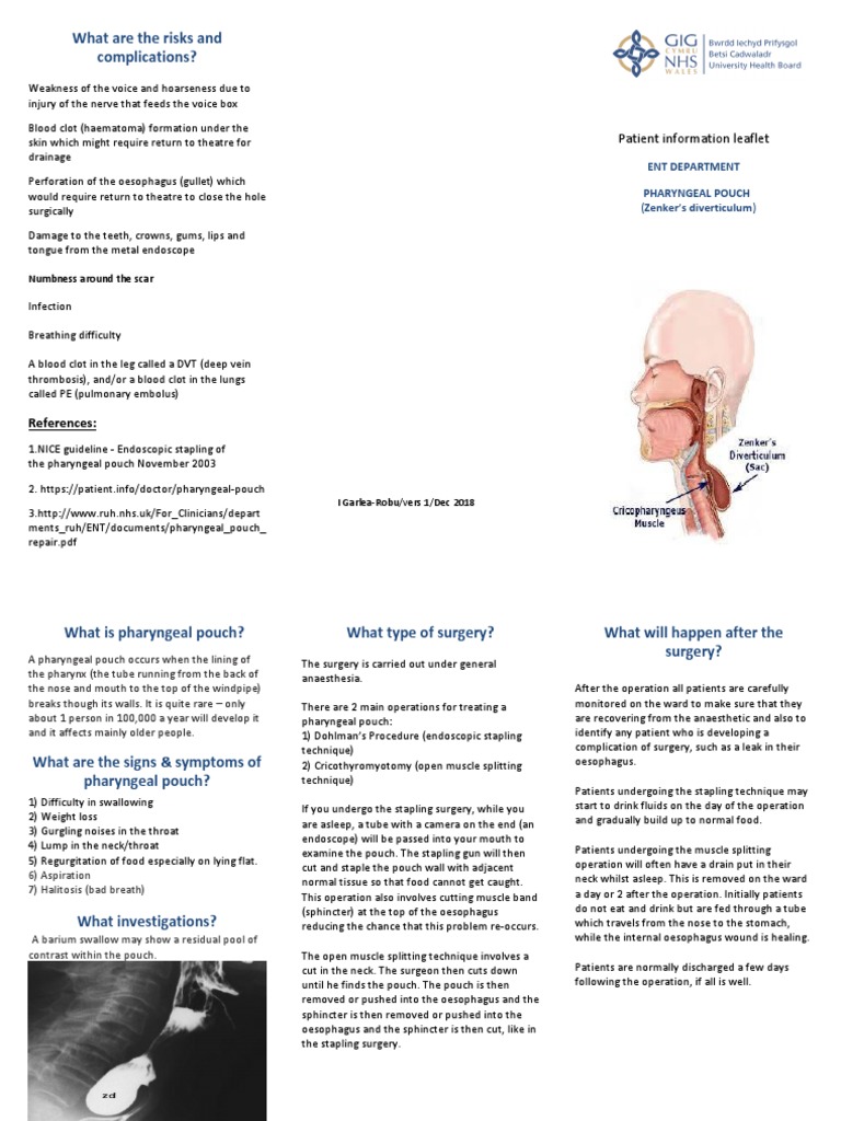 Pharyngeal Pouch Leaflet PDF Esophagus Surgery