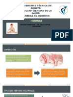 Hernia Inguinal y Umbilical