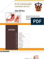 Úlcera péptica complicada: anatomía, factores de riesgo y tratamiento (UPC